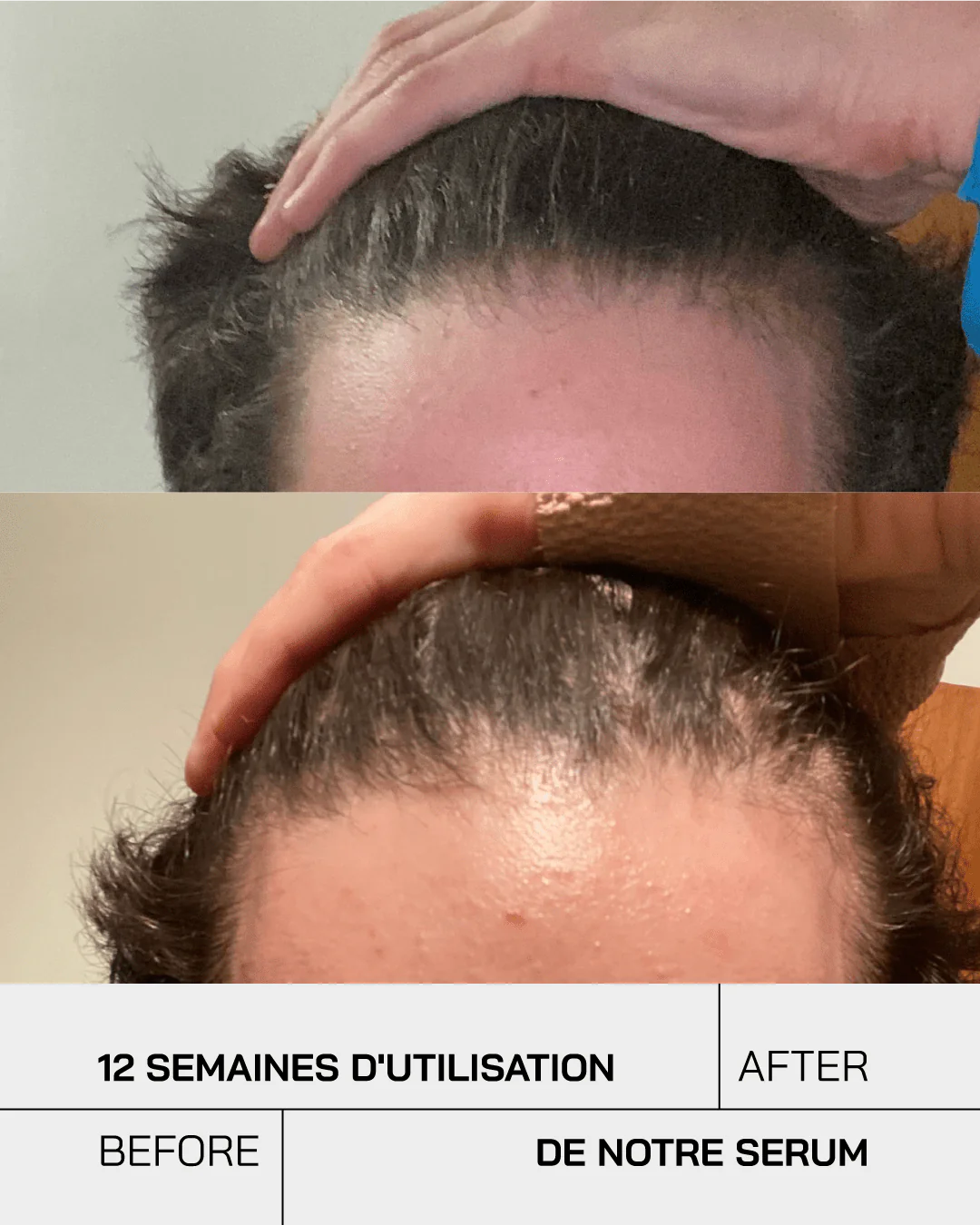 Touché Sérum capillaire Anti Chute – Image 8