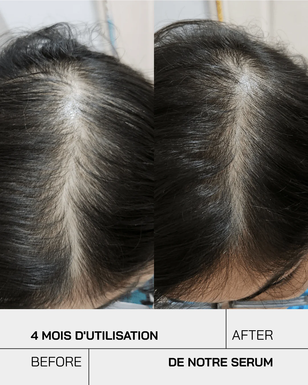 Touché Sérum capillaire Anti Chute – Image 9
