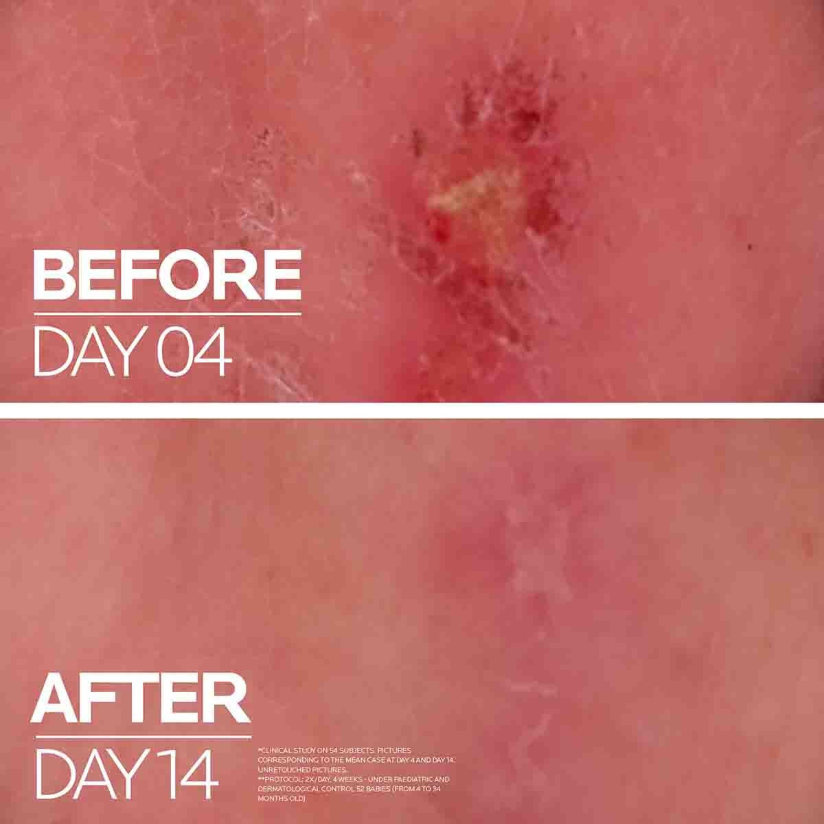 LA ROCHE POSAY Cicaplast Baume B5+ Crème Ultra-Réparatrice Apaisante 40ml – Image 6