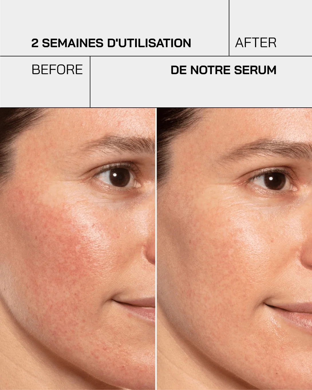 Touché Gel hydratant acide hyaluronique 3,5% – Image 12