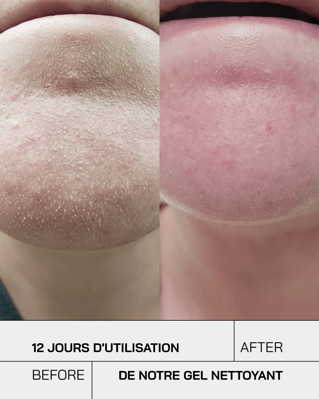 Touché Gel Nettoyant Purifiant Visage – Image 11