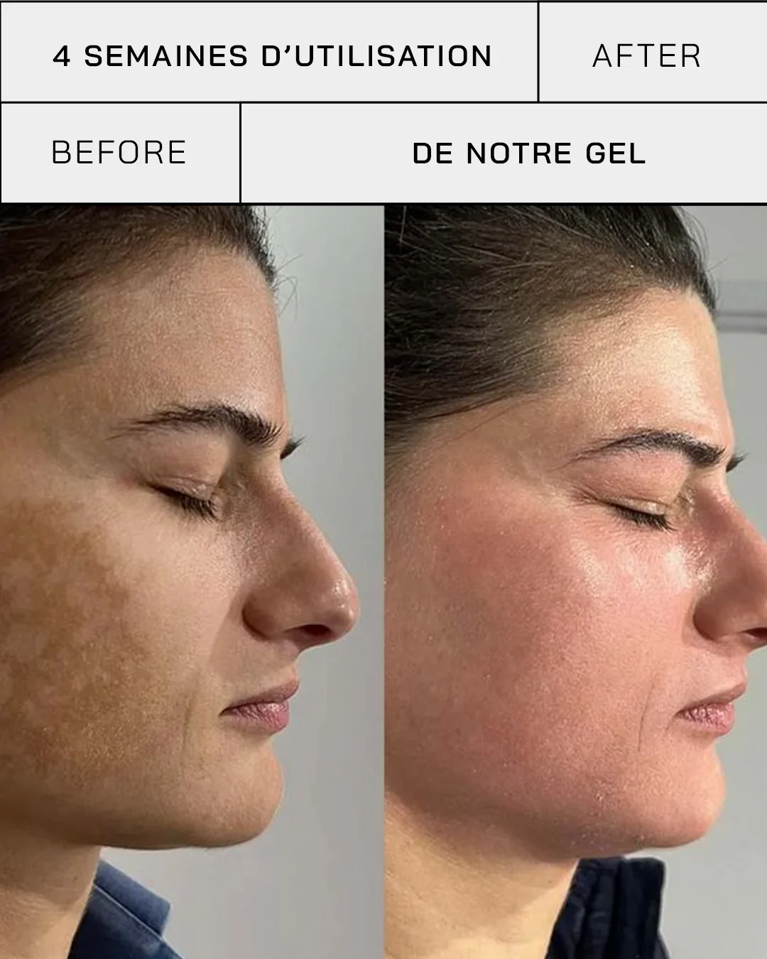 Touché Gel Vitamine C 11% + SPF 30 – Image 8