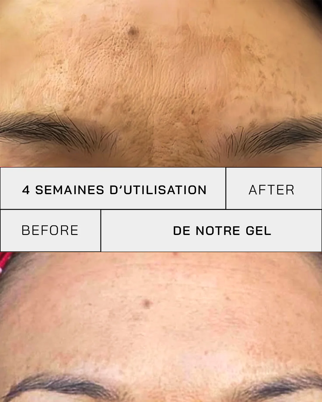 Touché Gel Vitamine C 11% + SPF 30 – Image 9